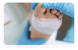 Atlanta diabetic foot ulcer patient receiving mobile wound care.