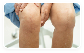 Atlanta post-surgery patient showing her wound care specialist their knee.