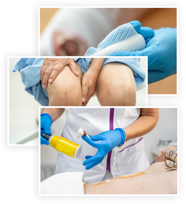 Wound care at skilled nursing facility.