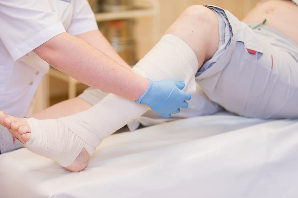 Mobile venous ulcer care in Atlanta.
